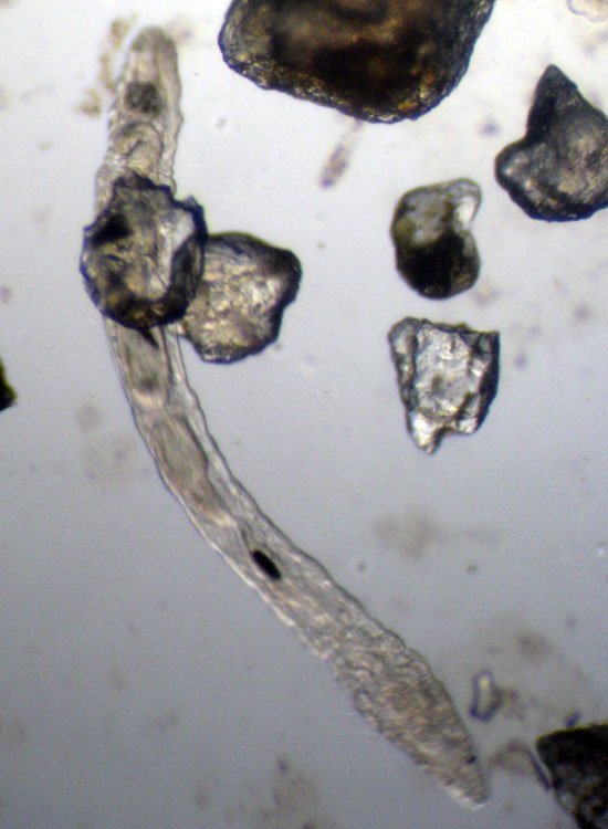 Microscopia delle spiagge adriatiche